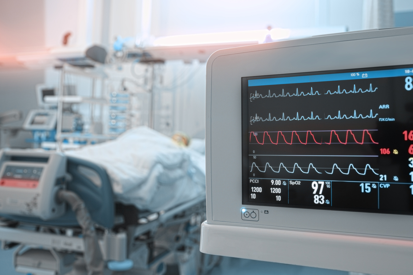 Heart Monitor with ECG Lines on the Background of Critical Patie
